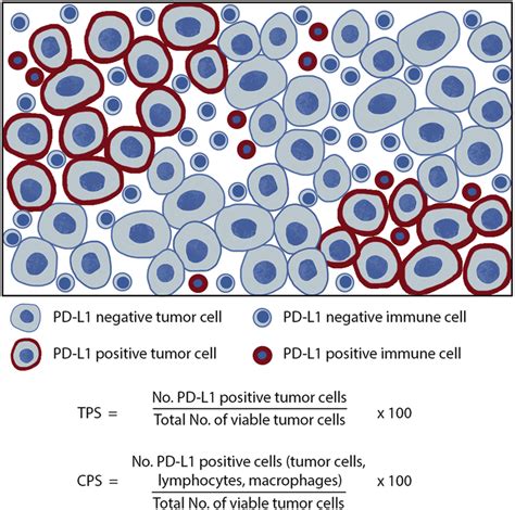 tumor cell proportion score